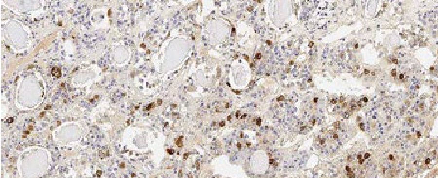 Cabeza, cuello y endocrinología