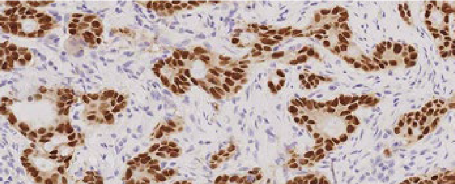 Patología gastrointestinal
