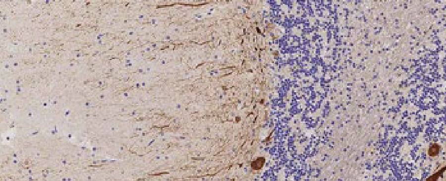 Neuropatología