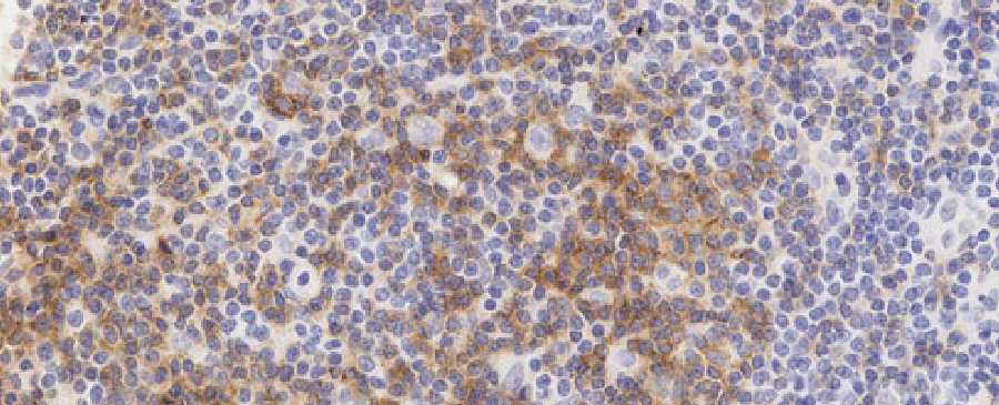 Oncopatología